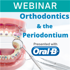 Webinar - Orthodontics & the Periodontium